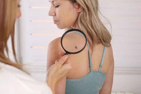 What Are Traditional Skin Lesion Removal Methods Huntingdon?