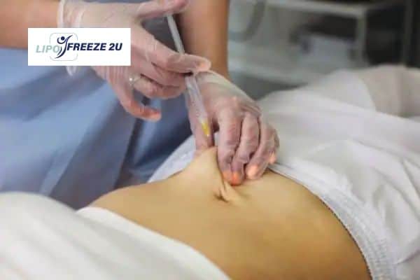 How Does Aqualyx Fat Dissolving Injection Work to Break Down Fat Huntingdon?