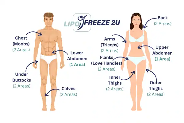 Areas you can have fat freezing treatment Huntingdon
