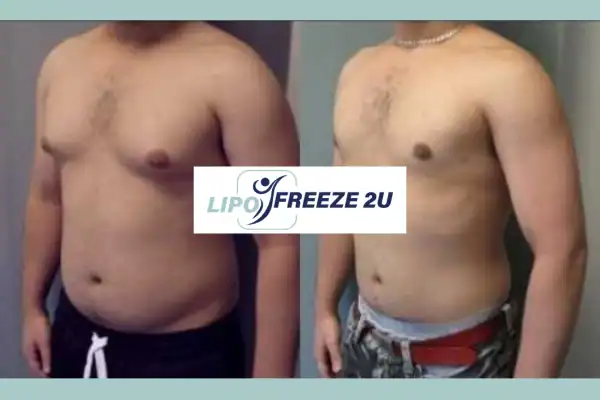 How Long Does It Take to See Results Huntingdon?