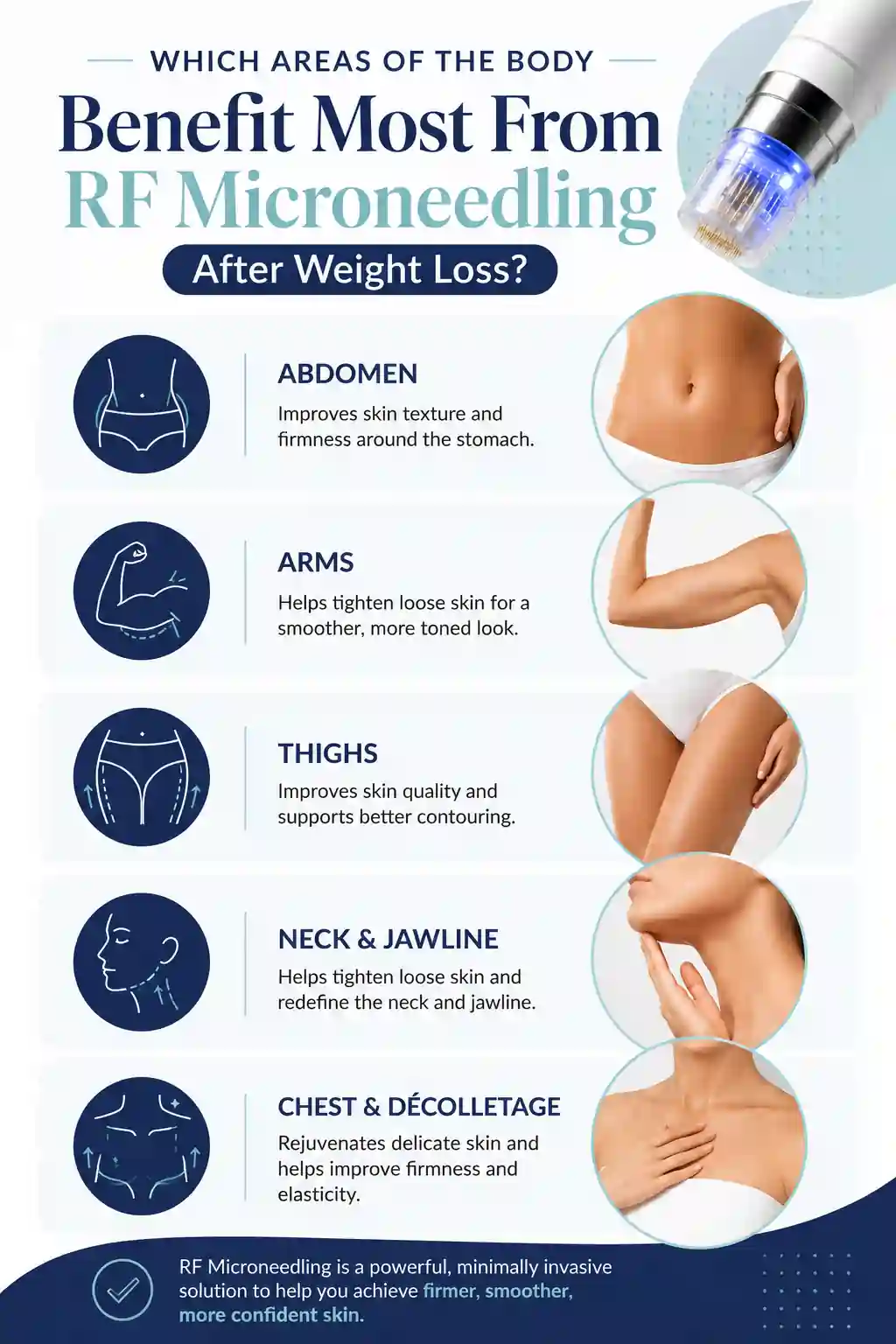 Which Areas of the Body Benefit Most From RF Microneedling After Weight Loss Huntingdon